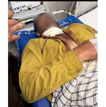 لاھور (ٹی این ایس) اسلام پورہ گلے پر ڈور پھرنے سے سگیاں کے رہائشی 35 سالہ غلام مصطفیٰ کے زخمی ہونے کا معاملہ ۔