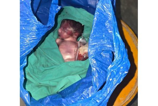 اسلام آباد (ٹی این ایس) ترامڑی چوک میں نومولود کی لاش کچرے دان میں پھینکنے کا مبینہ واقعہ، نجی اسپتال کا عملہ ملوث شہزاد ٹاؤن پولیس نے مشتبہ شخص کو حراست میں لے لیا، نومولود کی لاش تحویل میں لے کر اسپتال منتقل، واقعے کی تحقیقات شروع