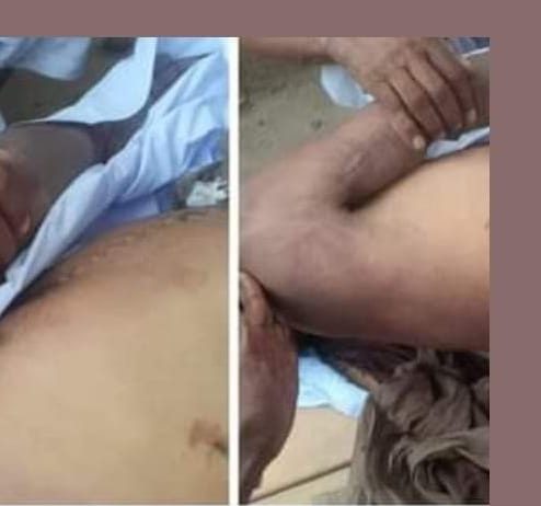 Khanewal (TNS) The law of the jungle is violated in Khanewal. Serious violation of human rights in the hands of Kachakho police station.