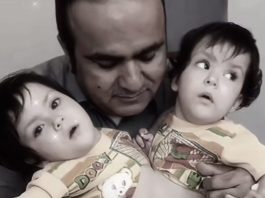 Islamabad(TNS) : Pakistani twins honored in Riyadh: A tale of medical marvel, Pak-Saudi friendship